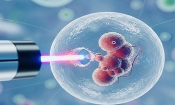 لیزر هچینگ در درمان ناباروری | افزایش شانس موفقیت IVF
